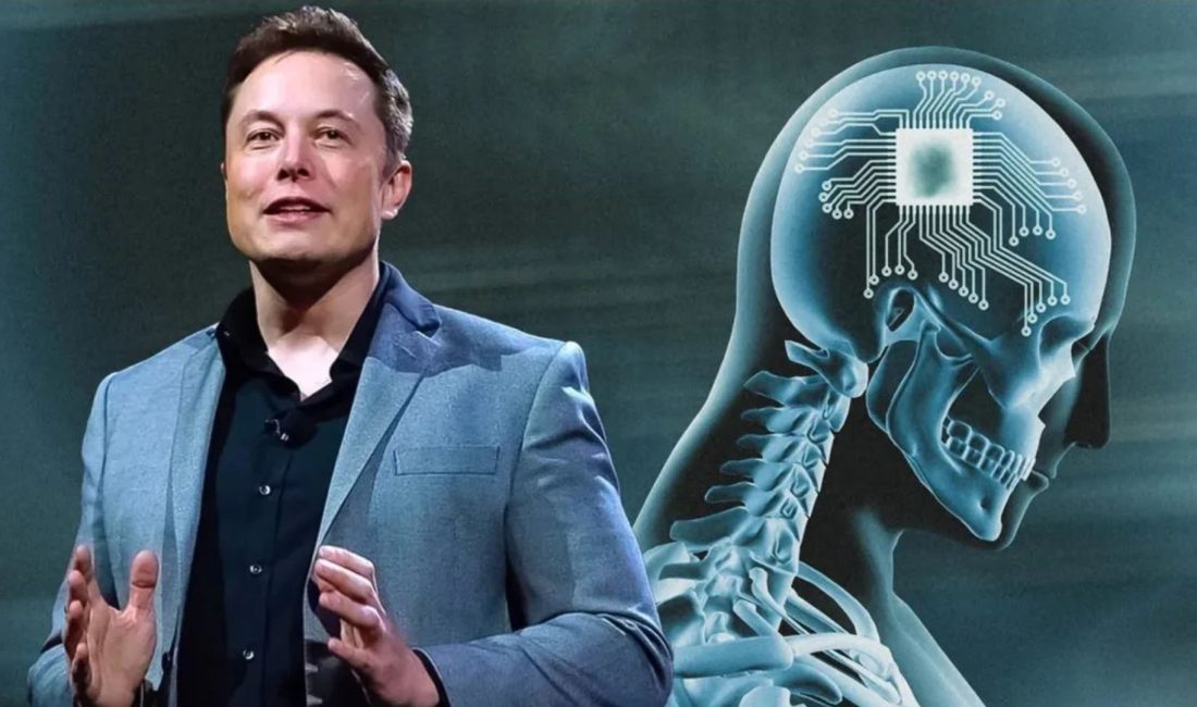 Elon Musk’ın beyin implantı şirketi Neuralink dünya genelinde denemeler için