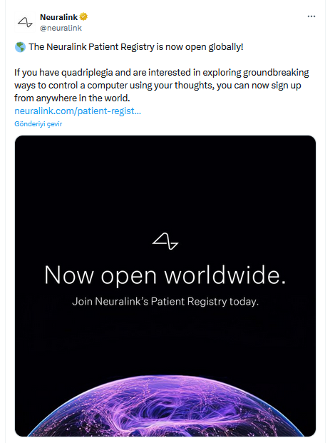 Elon Musk Beyin İmplantı Denemeleri İçin Katılımcı Arıyor - 1